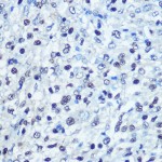 KO-Validated SAMHD1 Rabbit pAb (20 μl)