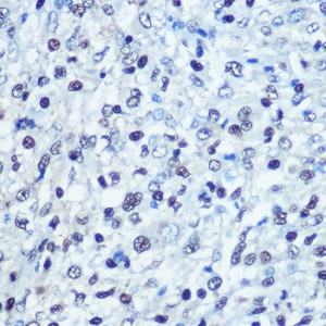 KO-Validated SAMHD1 Rabbit pAb (20 μl)