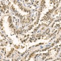 KD-Validated METTL3 Rabbit pAb (20 μl)