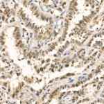 KD-Validated METTL3 Rabbit pAb (20 μl)