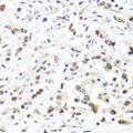 KO-Validated HIRA Rabbit pAb (20 μl)