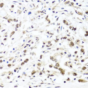 KO-Validated HIRA Rabbit pAb (20 μl)