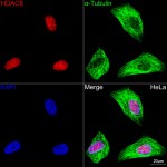 KO-Validated HDAC8 Rabbit mAb (20 μl)