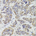 KO-Validated SUCLG2 Rabbit pAb (20 μl)