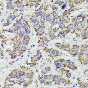 KO-Validated SUCLG2 Rabbit pAb (20 μl)