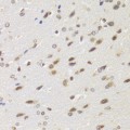 KO-Validated WSTF Rabbit pAb (20 μl)