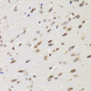 KO-Validated WSTF Rabbit pAb (20 μl)