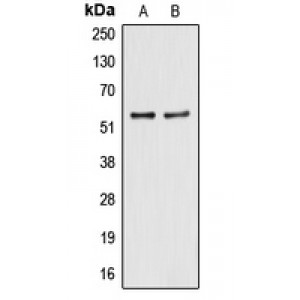 LifeSab™ ALDH2 Rabbit pAb (50 µl)