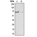 LifeSab™ Arylsulfatase E Rabbit pAb (50 µl)