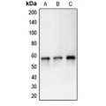 LifeSab™ Carbonic Anhydrase 9 Rabbit pAb (50 µl)