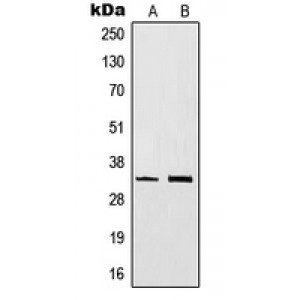 LifeSab™ CD20 Rabbit pAb (50 µl)