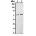 LifeSab™ Carboxypeptidase N 1 Rabbit pAb (50 µl)