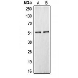 LifeSab™ Carboxypeptidase N 1 Rabbit pAb (50 µl)