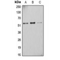 LifeSab™ Cytochrome P450 2D6 Rabbit pAb (50 µl)