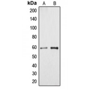 LifeSab™ Cytochrome P450 4A11/22 Rabbit pAb (50 µl)