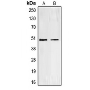 LifeSab™ Endothelin A Receptor Rabbit pAb (50 µl)