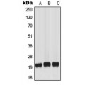 LifeSab™ MART-1 Rabbit pAb (50 µl)