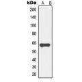 LifeSab™ GDF9 Rabbit pAb (50 µl)