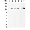 LifeSab™ mGLUR6 Rabbit pAb (50 µl)