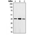 LifeSab™ HOXB2 Rabbit pAb (50 µl)