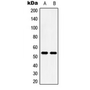 LifeSab™ 5-HT2B Rabbit pAb (50 µl)