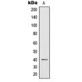 LifeSab™ IL-12B Rabbit pAb (50 µl)