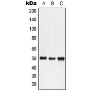 LifeSab™ LTBR Rabbit pAb (50 µl)