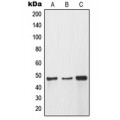 LifeSab™ MMP12 Rabbit pAb (50 µl)