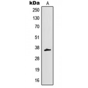 LifeSab™ MT-ND1 Rabbit pAb (50 µl)