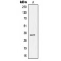 LifeSab™ NKX3-1 Rabbit pAb (50 µl)