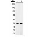 LifeSab™ PDK1 Rabbit pAb (50 µl)