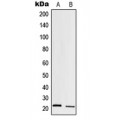 LifeSab™ Trypsin 1 Rabbit pAb (50 µl)