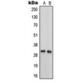 LifeSab™ Trypsin 3 Rabbit pAb (50 µl)