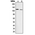 LifeSab™ Focal Adhesion Kinase (pY861) Rabbit pAb (50 µl)