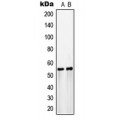 LifeSab™ GLUT3 Rabbit pAb (50 µl)