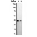 LifeSab™ STEAP1 Rabbit pAb (50 µl)