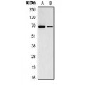 LifeSab™ ADCK2 Rabbit pAb (50 µl)