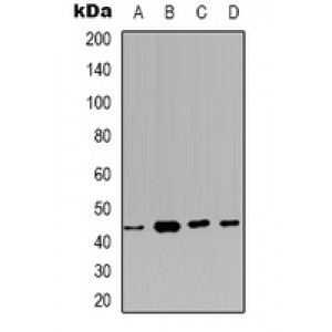 LifeSab™ CSGALNACT2 Rabbit pAb (50 µl)