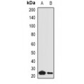 LifeSab™ Complement C1QA Rabbit pAb (50 µl)