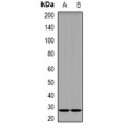 LifeSab™ DKK4 Rabbit pAb (50 µl)