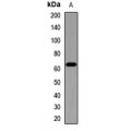 LifeSab™ NUMBL Rabbit pAb (50 µl)