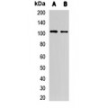 LifeSab™ MetRS Rabbit pAb (50 µl)