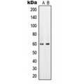 LifeSab™ PAHT Rabbit pAb (50 µl)