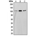 LifeSab™ SND1 Rabbit pAb (50 µl)