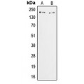 LifeSab™ ZFP106 Rabbit pAb (50 µl)