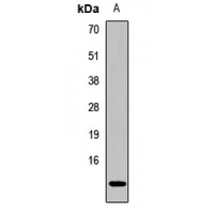 LifeSab™ CKS2 Rabbit pAb (50 µl)