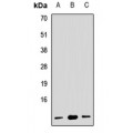 LifeSab™ RPL19 Rabbit pAb (50 µl)