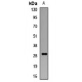 LifeSab™ GS28 Rabbit pAb (50 µl)