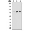 LifeSab™ LIV-1 Rabbit pAb (50 µl)