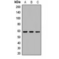 LifeSab™ LPCAT1 Rabbit pAb (50 µl)